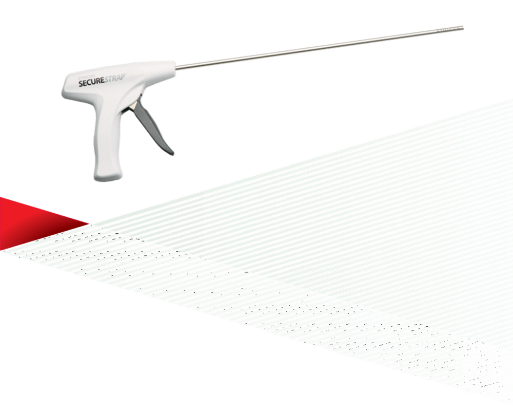 Устройство фиксации хирургическое ETHICON SECURESTRAP c 5-мм рассасывающимися скобами